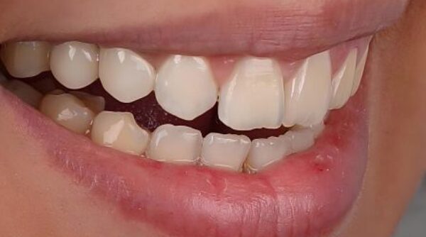 After -The Beresford Clinic