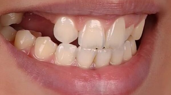 Before - The Beresford Clinic