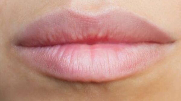 After -The Beresford Clinic