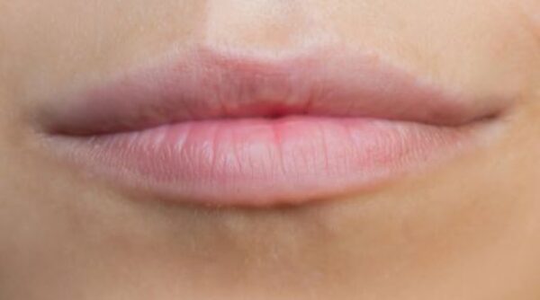 Before - The Beresford Clinic