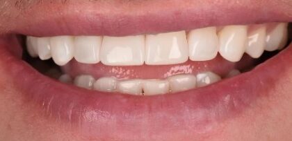 After -The Beresford Clinic