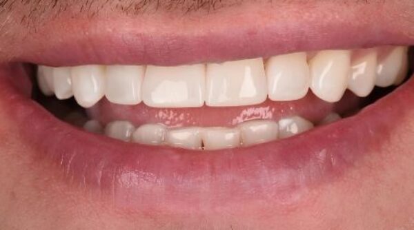 After -The Beresford Clinic