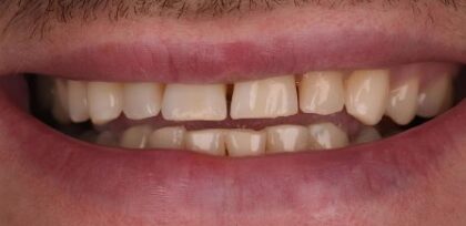 Before - The Beresford Clinic