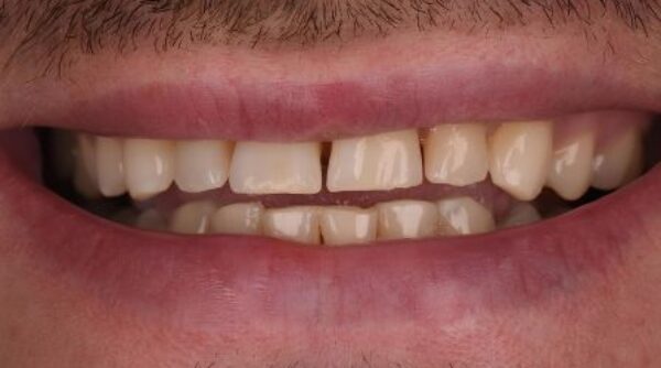 Before - The Beresford Clinic