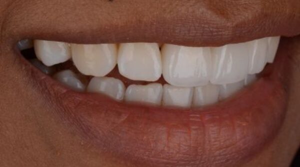 After -The Beresford Clinic