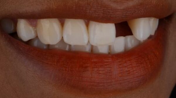 Before - The Beresford Clinic