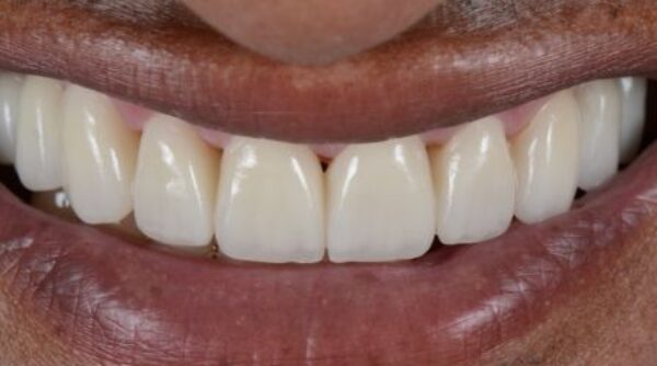 After -The Beresford Clinic