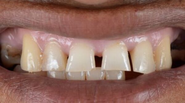 Before - The Beresford Clinic