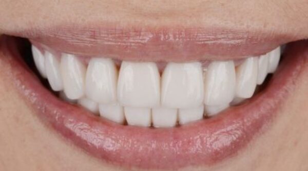 After -The Beresford Clinic