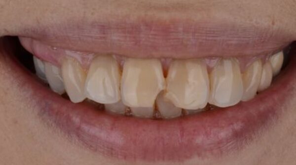 Before - The Beresford Clinic