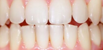 After -The Beresford Clinic