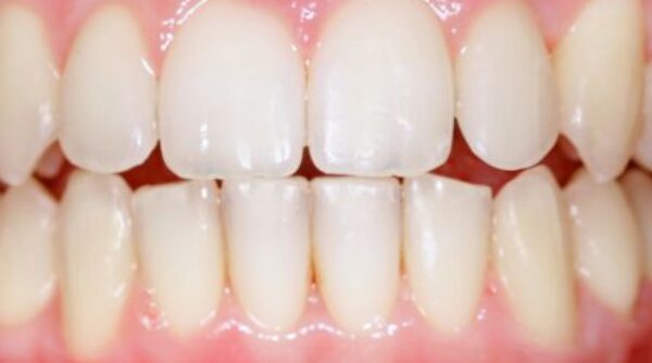 After -The Beresford Clinic