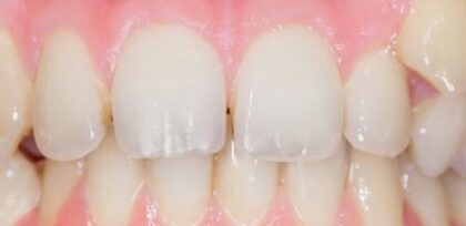 Before - The Beresford Clinic