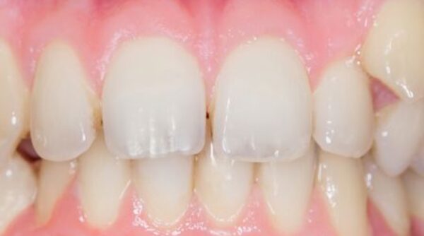 Before - The Beresford Clinic