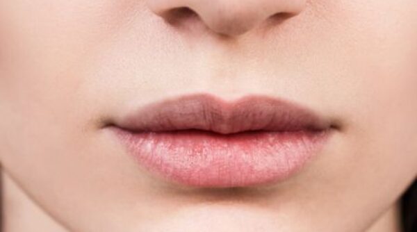 After -The Beresford Clinic