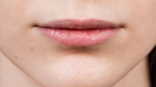 Before - The Beresford Clinic