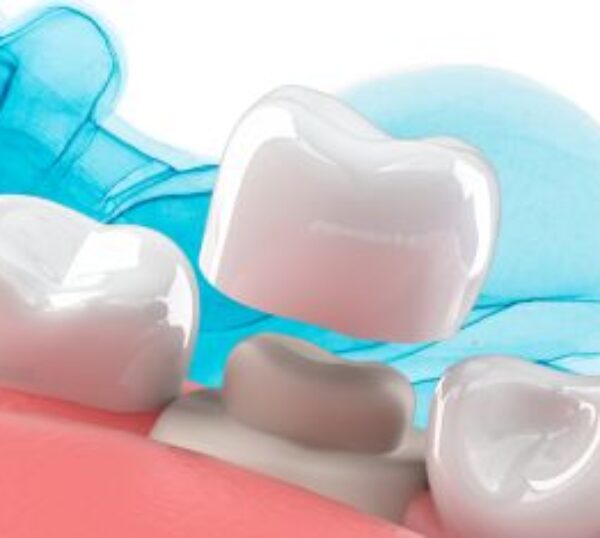 Treatment - The Beresford Clinic