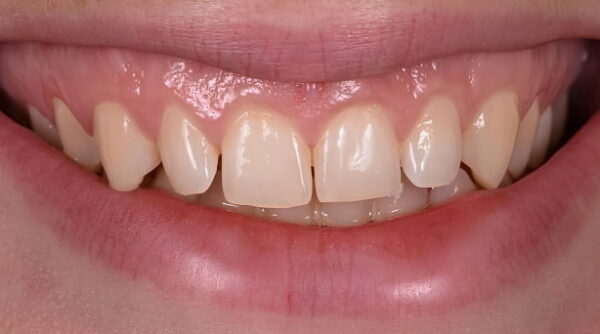 Before - The Beresford Clinic